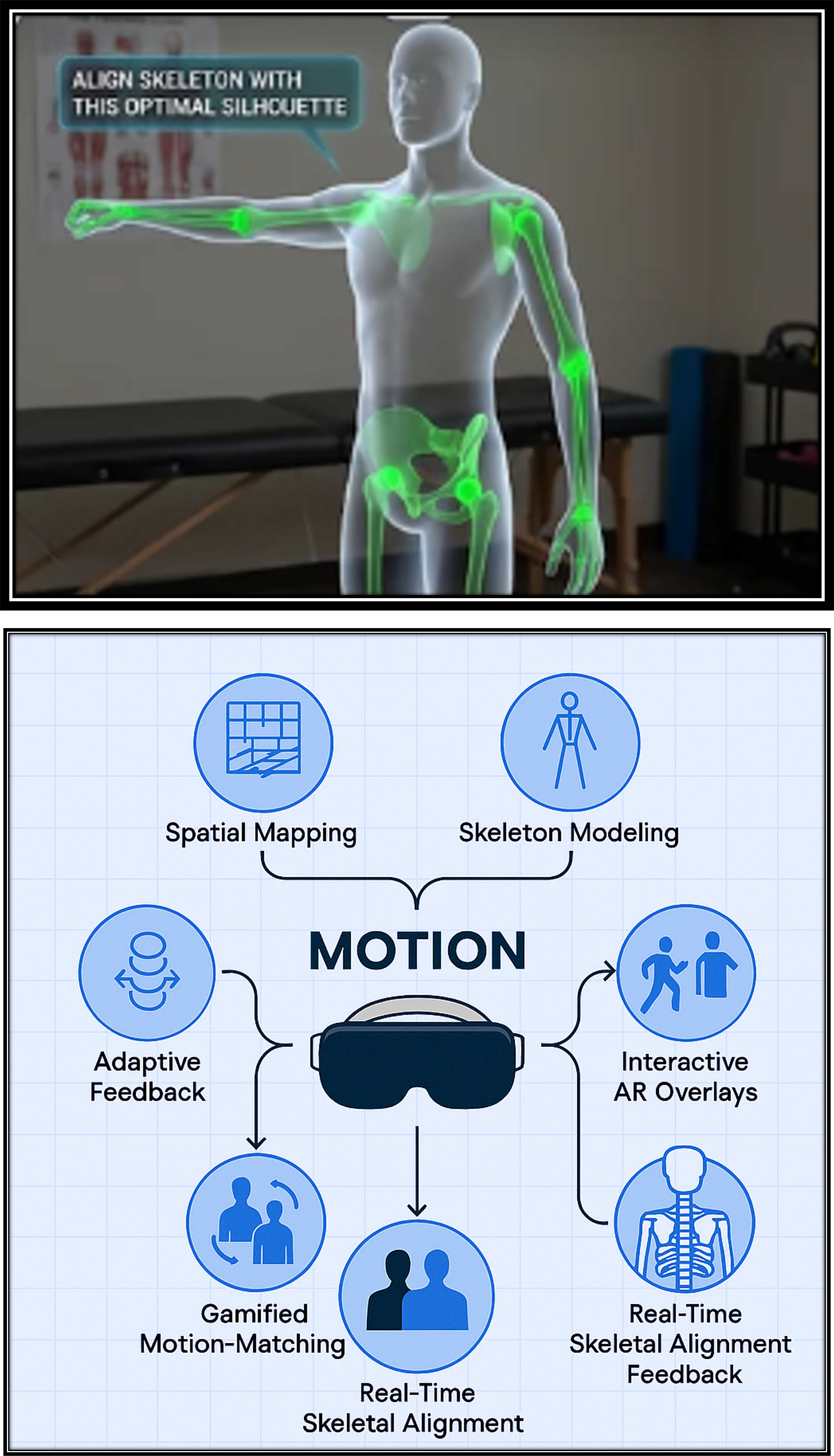 MOTION: AI-Driven Biomechanical Motion Capture for Augmented Reality Rehabilitation