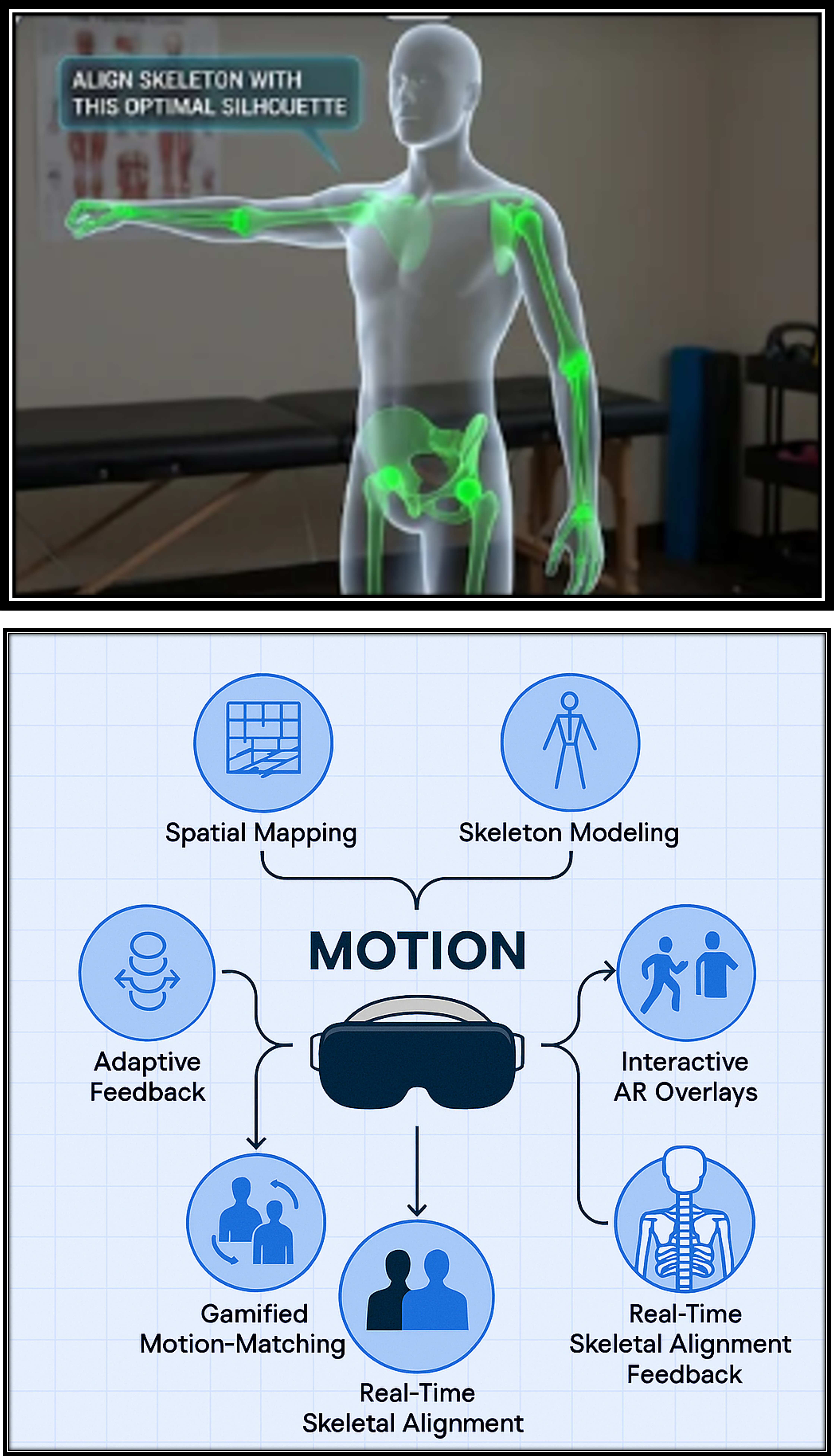 MOTION: AI-Driven Biomechanical Motion Capture for Augmented Reality Rehabilitation